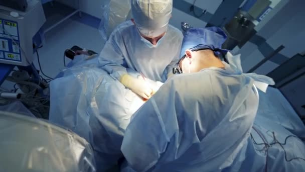 Sala Cirúrgica Avançada Cirurgiões Profissionais Uniforme Médico Realizam Uma Operação — Vídeo de Stock