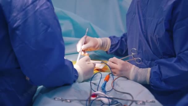 手術プロセスの閉鎖 病院の外科医の医療チームは 侵襲的外科的介入を最小限に抑える — ストック動画