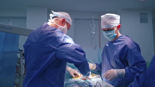 Ιατρική Ομάδα Στο Χειρουργείο Ομάδα Χειρουργών Στο Χειρουργείο Χειρουργικό Εξοπλισμό — Αρχείο Βίντεο