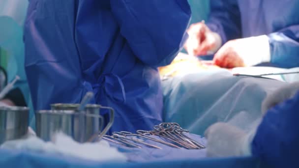Läkarteam Operation Kirurgiskt Team Som Utför Operation — Stockvideo