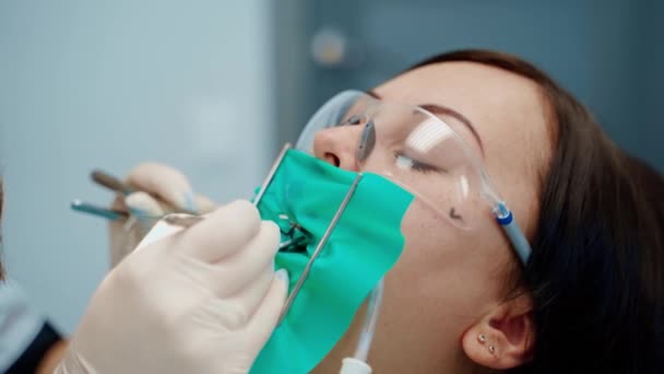 Uma Jovem Mulher Consultório Dentista Feche Procedimento Dentista Médico Dentes — Vídeo de Stock