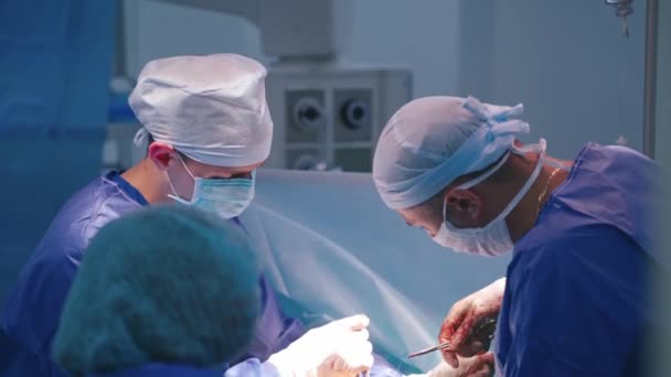 Медична Команда Хірургів Командний Хірург Роботі Під Час Операції Лікарні — стокове відео