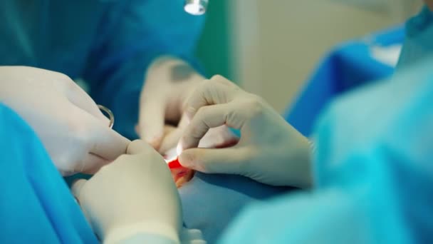 Plasztikai Sebészet Kórházi Műtőben Kozmetikai Műtétet Végző Orvosok — Stock videók