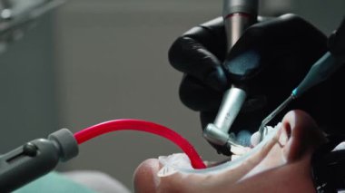 Dişçi tıbbi manipülasyonlar yapıyor. Cerrahi aletli dişçinin elleri