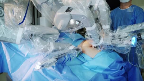 Operace Systémem Vinci Pokročilý Robotický Chirurgický Přístroj Nemocnici — Stock video