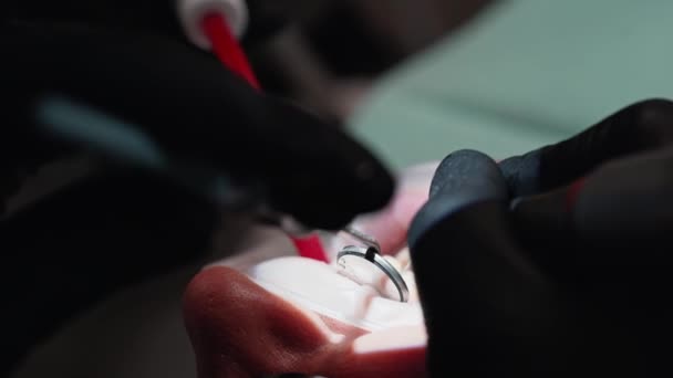 Dentista Realizando Operação Tratamento Médico Consultório Dentista — Vídeo de Stock