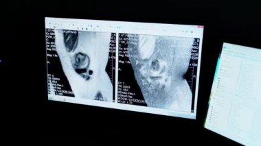 Manyetik rezonans görüntüsü. Manyetik rezonans görüntüleme ile hasta taraması sonuçları