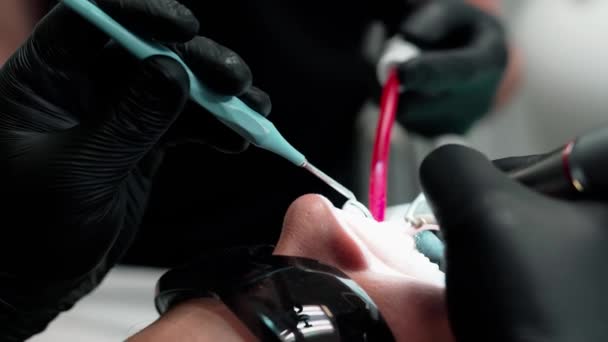 Hastanın Dişçi Kliniği Tedavi Sırasında Dişçi Muayenehanesindeki Hasta — Stok video