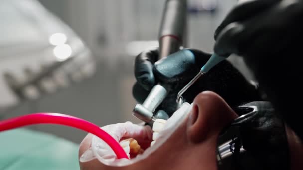 Paziente Durante Processo Dentale Primo Piano Del Paziente Sottoposto Trattamento — Video Stock