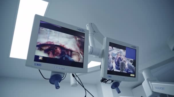 现代外科系统 腹腔镜设备的外科手术 — 图库视频影像