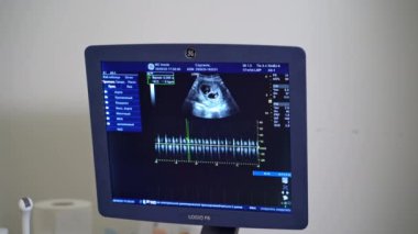 Sonograf iş yerinde ultrason makinesi kullanıyor. Ultrason ile hastanın profesyonel doktor taraması