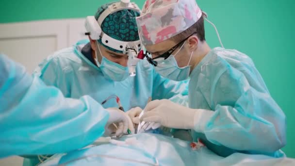 Chirurdzy Operujący Szpitalu Sali Operacyjnej Szpitala Zróżnicowany Zespół Profesjonalnych Chirurgów — Wideo stockowe