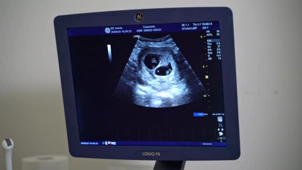 人間の心臓の超音波手順 医師超音波検査 病院で患者を診察する — ストック動画