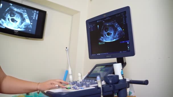Procedimento Ultrassonografia Hospital Moderno Médico Realizando Ultra Som Coração Paciente — Vídeo de Stock
