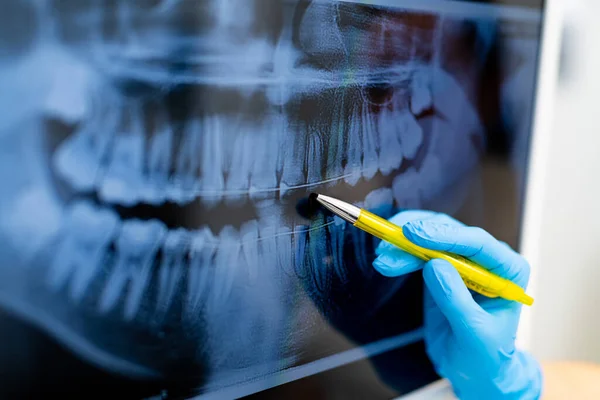 stock image X-ray dentistry technologies. Teeth examining in modern hospital.