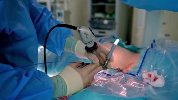 Chirurdzy Operujący Sali Operacyjnej Zespół Chirurgiczny Wykonujący Operacje Nowoczesnym Szpitalu — Wideo stockowe