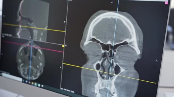 Medizinischer Wissenschaftler Arbeitet Mit Hirnscanner — Stockvideo