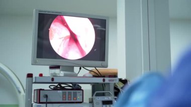 Doktorlar tıbbi ameliyat yapıyor. Modern ameliyathanede cerrahi müdahalede işbirliği yapan bir ekip.