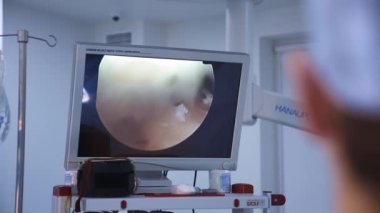 Hastane ameliyathanesinde ameliyat. Cerrahlar hastanede anestezi altında ameliyat yaparlar.