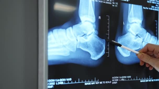 Врачи Осматривают Рентген Команда Врачей Мониторе Клинике Обсуждает Рентген Пациента — стоковое видео