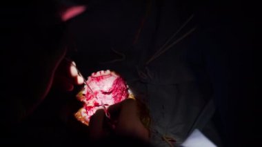 Beyin ameliyatı. Ameliyathanede ameliyat ekipmanlarıyla bir grup cerrah..