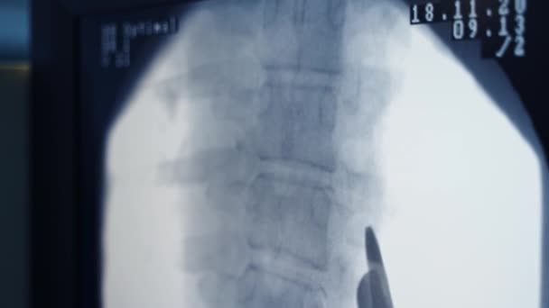 Équipement Moderne Dans Salle Opération Chirurgie Rachis Radiographies Colonne Vertébrale — Video