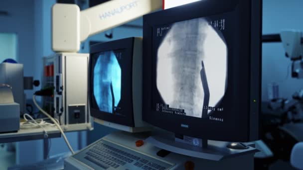Equipamiento Moderno Quirófano Cirugía Columna Radiografía Columna Vertebral — Vídeo de stock