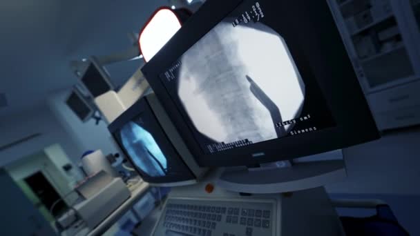 Ameliyathanede Modern Ekipman Var Omurga Ameliyatı Omurganın Röntgenleri Bir Grup — Stok video