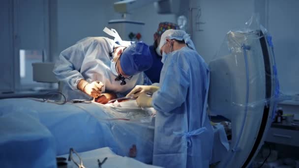 Zespół Medyczny Wykonujący Operacje Chirurgiczne Jaskrawo Nowoczesnej Sali Operacyjnej Nowoczesne — Wideo stockowe
