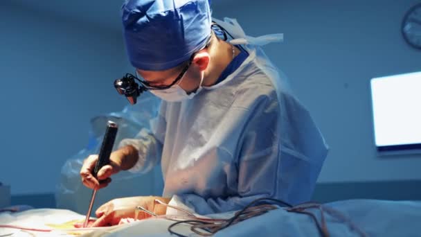 Operazione Ospedale Concetto Sanitario Neurochirurghi Lavoro Concentrazione Selettiva Sfondo Stanza — Video Stock