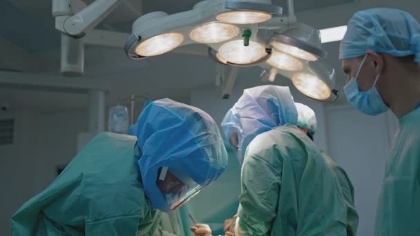 Operują Zespół Medyczny Wykonujący Operacje Szpitalnej Sali Operacyjnej Praca Narzędziami — Wideo stockowe