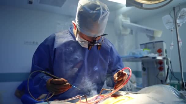 领导手术的男性神经外科医生 外科医生持有和应用特殊的工具在手术和烟雾来自病人的伤口 将外科钳交给医生的助手 — 图库视频影像