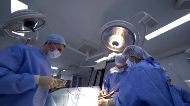 神経外科手術が実施されています 革新的な楽器を使用するプロフェッショナルが閉じます 下からの眺め — ストック動画