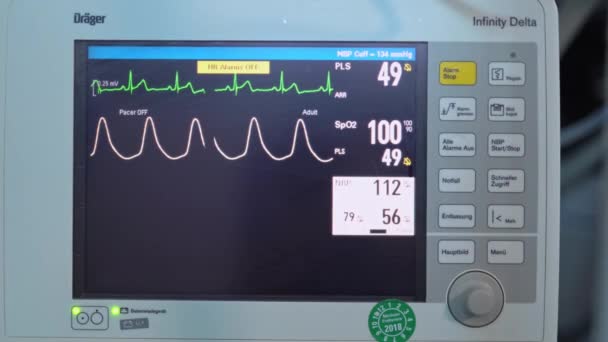 Monitorować Rytm Bicie Serca Pacjenta Podczas Operacji Sprzęt Medyczny Niezbędny — Wideo stockowe
