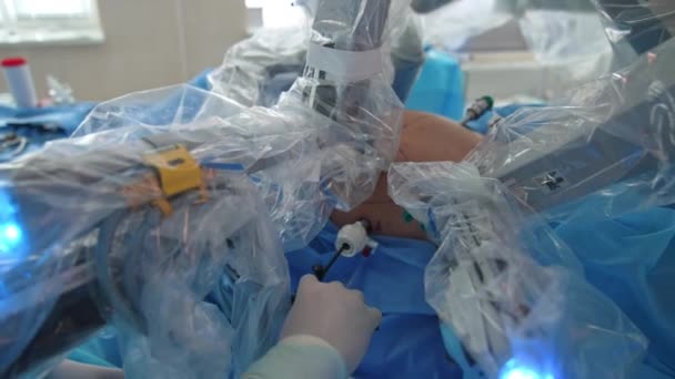 Χειρουργός Που Εφαρμόζει Σύγχρονο Τεχνολογικό Εξοπλισμό Ασθενή Ρομποτικά Χέρια Βοηθούν — Αρχείο Βίντεο