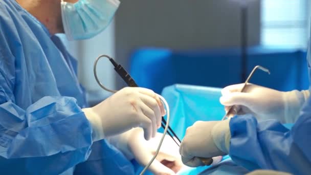 Gumikesztyűs Sebészek Kezei Tartják Műtőeszközöket Műtét Végzése Műtőben — Stock videók