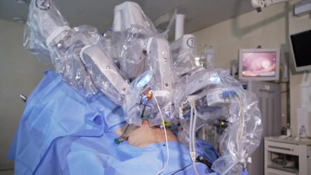 Ρομπότ Ντα Βίντσι Κάνει Εγχείρηση Στον Ασθενή Καινοτόμος Τεχνολογικός Εξοπλισμός — Αρχείο Βίντεο