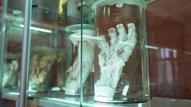 Ανθρώπινα Όργανα Στο Μουσείο Ανθρώπινα Όργανα Φορμαλίνη Ανατομικό Μουσείο — Αρχείο Βίντεο