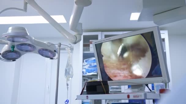 Chirurgien Professionnel Effectuant Opération Groupe Travailleurs Médicaux Opérant Salle Opération — Video