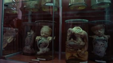 Tıp müzesinde formalin içinde bir insan. İnsan organlarının toplanması büyük kavanozlarda formaldehit ile korunur ve müzede dikey olarak sergilenir.