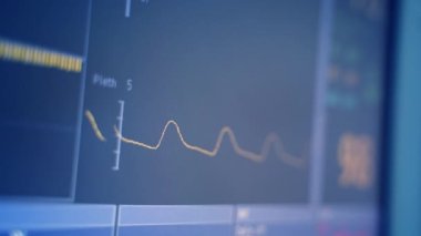 Kalp atışı Ekran Elektrokardiyografisi. Hastanedeki yoğun bakım monitöründe hayati belirtiler var.