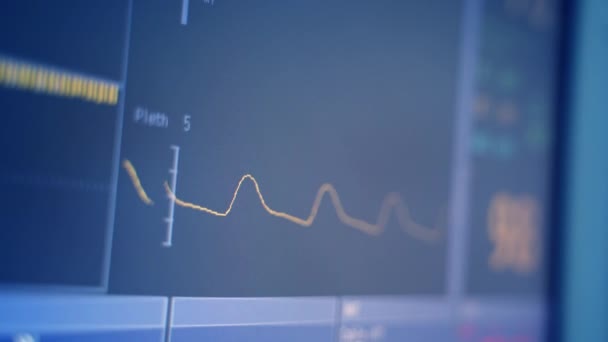 Srdeční Tep Monitor Elektrokardiografie Životní Funkce Monitoru Jip Nemocnici — Stock video