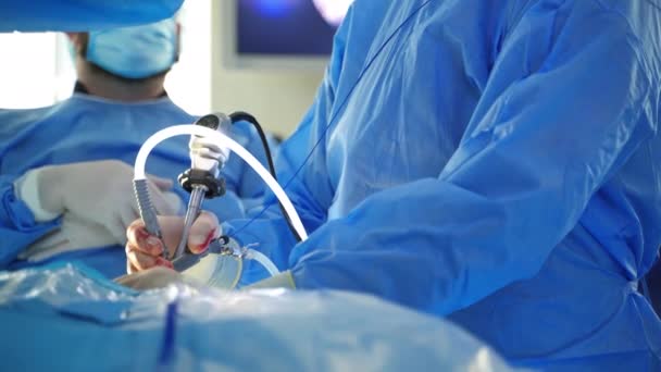 Cirugía Del Paciente Quirófano Del Hospital Disparo Diverso Equipo Cirujanos — Vídeos de Stock