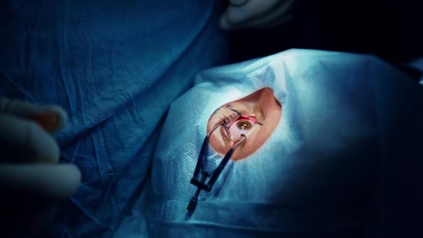 Lekarz Leczy Oczy Pacjenta Zbliżenie Oka Podczas Operacji Klinice Okulistycznej — Wideo stockowe