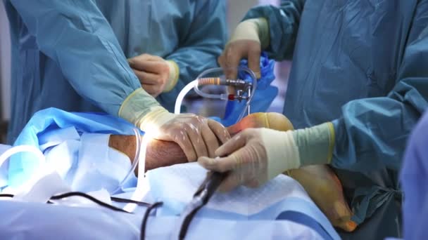在医院接受外科手术的病人 在手术室实施外科手术的医生合作小组 — 图库视频影像