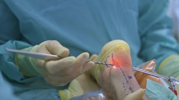 手术室的医务人员 实施外科手术的专业医生 — 图库视频影像
