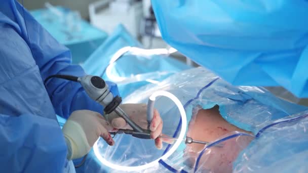 Sebészeti Műveletet Végző Csapat Műtétet Végző Sebész Csapat Sterilizált Körülmények — Stock videók