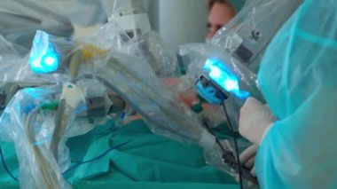 Ameliyat robot tarafından gerçekleştirildi. Laparoskopik apandisit ameliyatını kapat