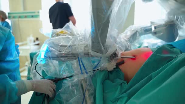 Robotműtétet Végző Sebész Sebészeti Robotot Használó Orvosok Kórházban Robottechnikai Berendezéssel — Stock videók