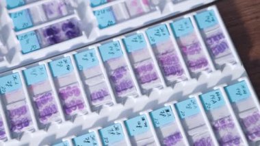 Laboratuvarda test örnekleri. Kan örneklerini özel gözlüklerle test edin.